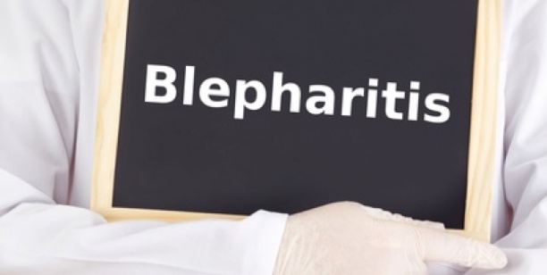 Ein Augenarzt hilft, wenn sie Probleme haben.