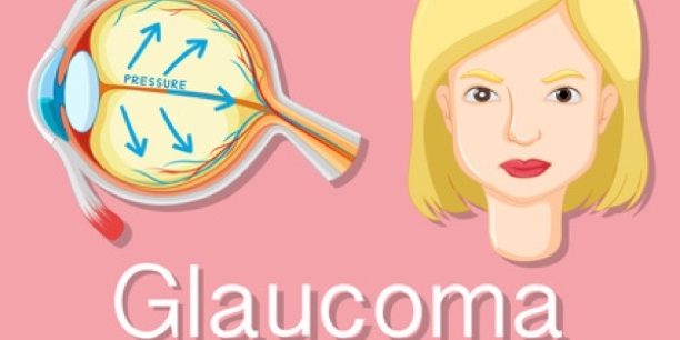 Glaukom muss behandelt werden. Glaukom muss behandelt werden.