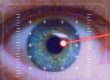 Lasertherapie bei Glaskörpertrübung in Mainz