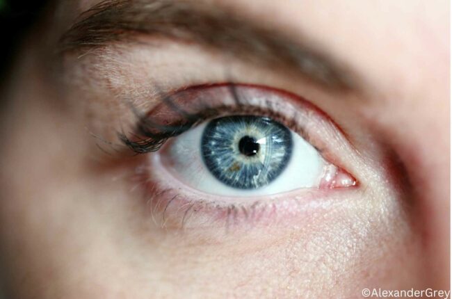 trockene-Augen-als-spaet-folge-einer-chemotherapie trockene Augen nach einer Chemo