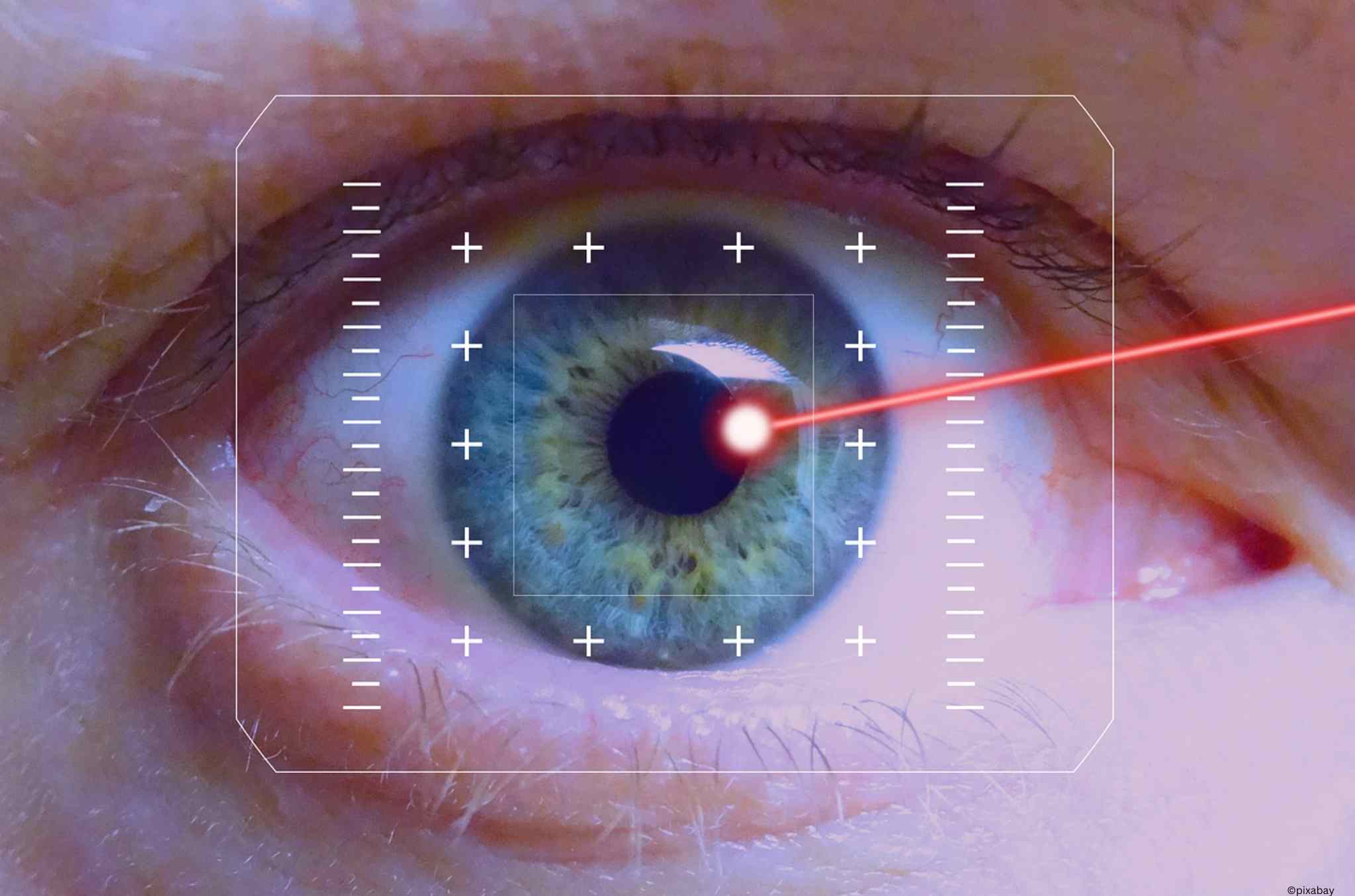 Augen wird von Laser behandelt