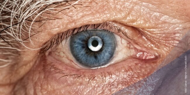 netzhauterkrankungen-im-alter Nahaufnahme vom Aug eines alten Mannes zum Thema Netzhauterkrankungen im Alter