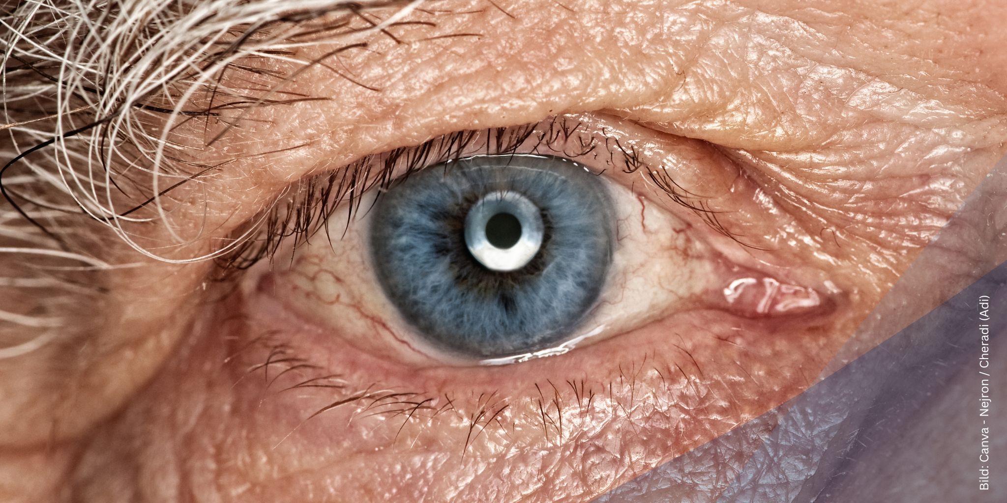 Nahaufnahme vom Aug eines alten Mannes zum Thema Netzhauterkrankungen im Alter